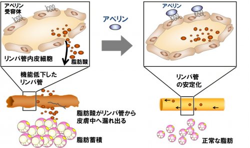 The impaired function of dermal lymphatic vessels lead to accumulation of...